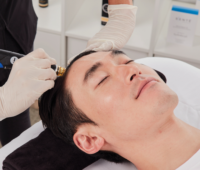 A Man getting Keravive Scalp Treatment at Sego Lily Spa in Bountiful, Layton, & Midvale, UT